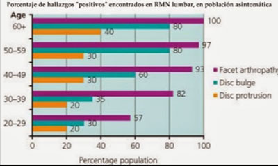 tabla hernia discal